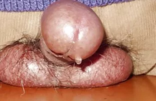 XXX Bespectacled Negrito పట్టు బడటం శృంగారమైన తెలుపు అమ్మాయి మరియు ప్రయోజనం పట్టింది క్షణం